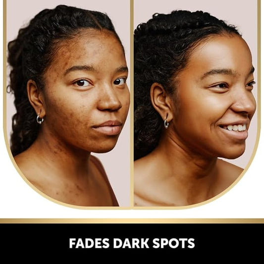 VALITIC Kojic Acid and Turmeric Dark Spot Corrector Soap – Skin Care Cleansing Duo - 2 Soap Bars and 200 Melting Paper Sheets - Infused with Vitamin C, Retinol and Collagen