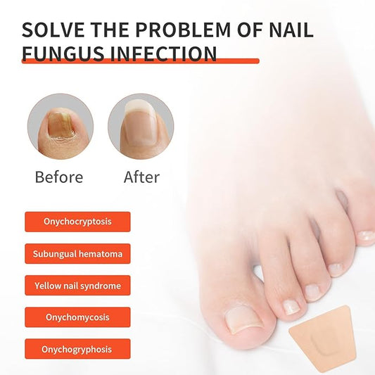 Toe Nail Fungus Treatments,Toenail Fungus Treatment Extra Strength,Fungal Nail Renewal Patches,Medical-Grade Adhesive,Gentle & Effective Nail Renewal Treatment,Strong Adhesion, No Irritation 32Pcs