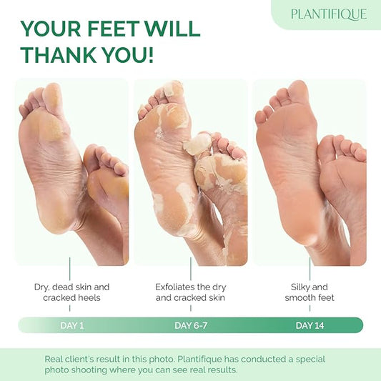 PLANTIFIQUE Foot Peeling Mask 4 Pack | Dermatologically Tested Repairs Heels & Removes Dry Dead Skin for Baby Soft Feet | Exfoliating Foot Peel Mask for Dry Cracked Feet | Strawberry