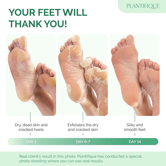 PLANTIFIQUE Foot Peeling Mask 1 Pack | Dermatologically Tested Repairs Heels & Removes Dry Dead Skin for Baby Soft Feet | Exfoliating Foot Peel Mask for Dry Cracked Feet | Peach