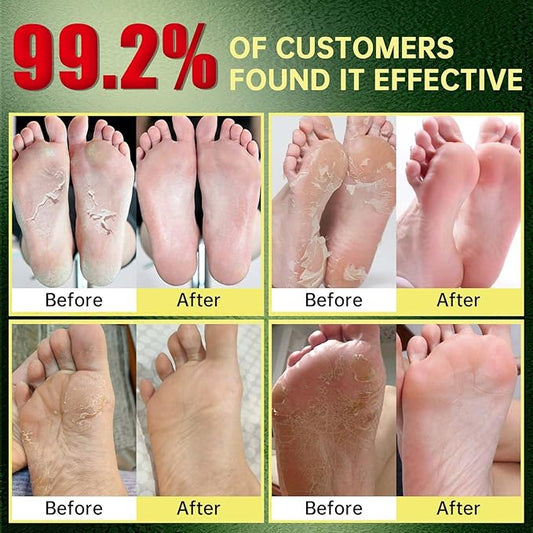 Foot Peeling Mask, Natural Exfoliating Foot Mask, Dead Skin Callus Remover Repair Heels, Hydrating Foot Care for Dry Cracked Feet(3 PacK)