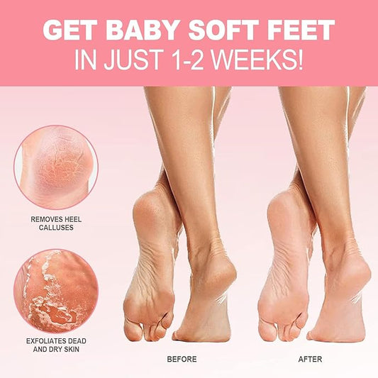 Foot Peel Mask - 3 Pairs - Exfoliating Peeling Callus Remover, Repairs Cracked Heels & Dead, Dry Skin, for Smoother and Softer Feet (Rose)