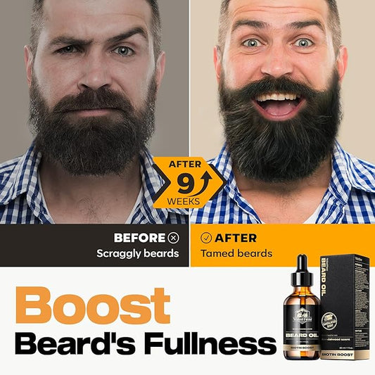 Waking Forest Sandalwood & Whiskey Beard Oil for Men - Biotin Mustache Oil with Vitamin E, Rosemary & Castor - Beard Care Softener, Strengthens, and Moisturizes - Beard Conditioner (1 oz)