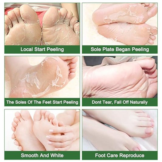 Foot Peeling Mask 5 Pack, Foot Mask Remove Dead Skin, Rough Callus and Cracked Heels, Dry Skin Moisturizer for Soft and Smooth Baby Touch Feet (Tea Tree)
