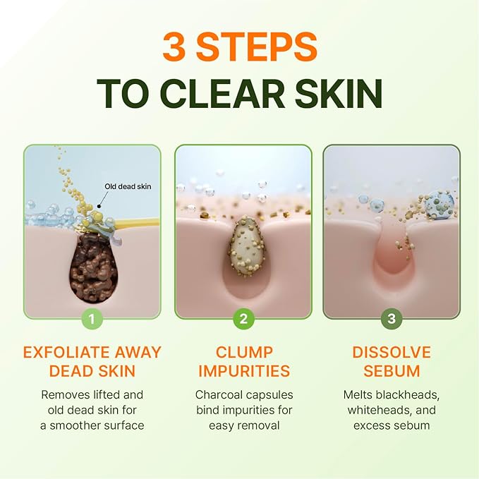 CENTELLIAN 24 Madeca Matcha Peeling Gel (5.07fl oz) – Gentle Exfoliator for Clear, Smooth & Balanced Skin, Korean Skin Care. Matcha-TECA Complex, Charcoal Capsules.