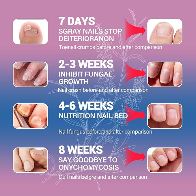 Toenail Fungus Treatment, Toenail Fungus Treatment Extra Strength, and Foot Fungus Treatment Extra Strength—plus Safely & Gently Nail Repair for Toenails and Fingernails (2-Pack) with File