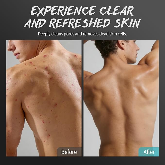 Men Body Scrub with Tea Tree Oil Exfoliating Body Scrub for Men Improve Odor Smooth Rough Skin Body Exfoliator Scrub for Back Chest Shoulders Butt Legs Mens Exfoliating Body Wash with 2% BHA 10% AHA