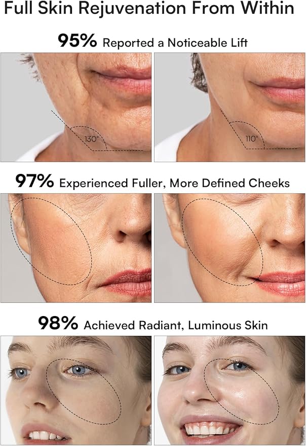 INIA 3-in-1 Skin Tightening Device True Beauty Glow Facial Massager Red Light Therapy for Face and Neck