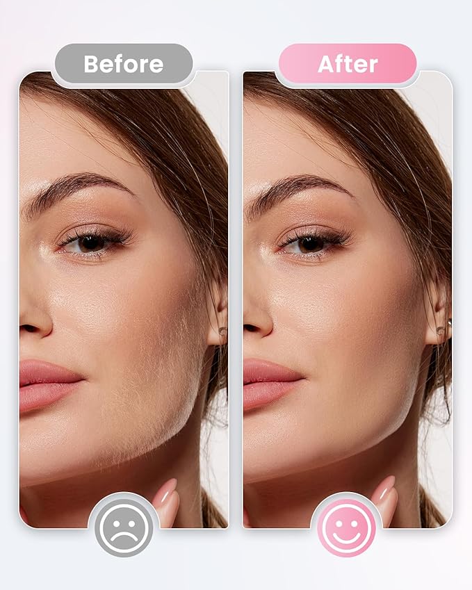 Dermaplane Razor For Women Face, 3 Adjustable Dermaplaning Tool, Facial Hair Removal Razors with Led Light for Peach Fuzz,Rechargeable Sonicsmooth Facial Hair Remover with 8 Replacement Blades (White)