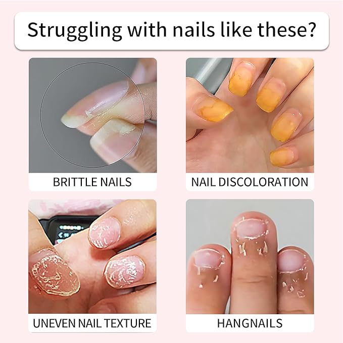 Cuticle Oil Pen Treat Hangnails,Nail Oil Pen, Women's Nail Repair Nutrient Serum,Gentle Formula Promotes Toenail Health and Beautiful Look (1PCS, 0.17 oz)