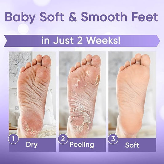 Foot Peel Mask - Foot Mask for Baby Soft Skin - Remove Dead Skin, Dry, Cracked Feet & Callus, Foot Spa, Made with Aloe Vera Extract for Women and Men (3 Pair (Pack of 1), Lavender)