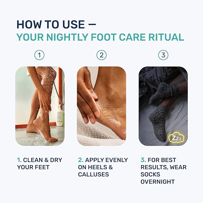 Urea Cream 40% & Salicylic Acid – Intensive Callus Remover for Feet – Maximum Strength Exfoliating Lotion with Ceramides, Peptides & Tea Tree – Repair Dry Cracked Heels & Corns – 4.3 oz