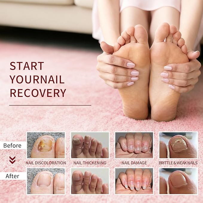 Cuticle Oil Pen Treat Hangnails,Nail Oil Pen, Women's Nail Repair Nutrient Serum,Gentle Formula Promotes Toenail Health and Beautiful Look (1PCS, 0.17 oz)