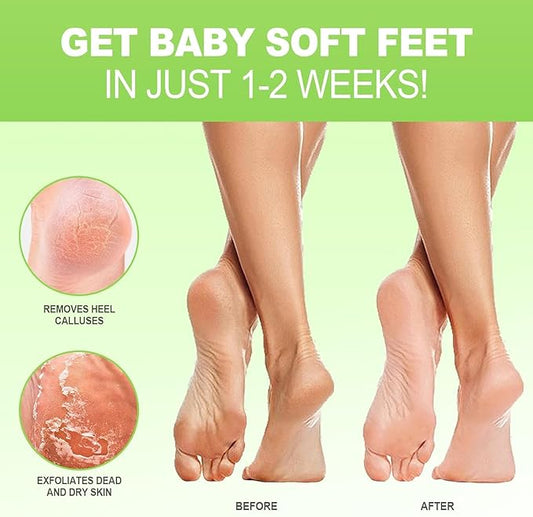 JVR Foot Peel Mask - 3 Pairs - Exfoliating Peeling Callus Remover, Repairs Cracked Heels & Dry Skin, for Smoother and Softer Feet (Aloe Vera)