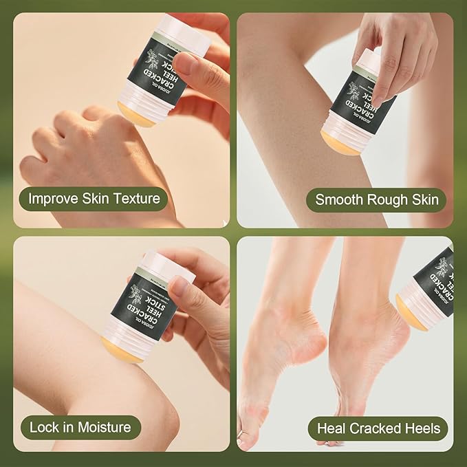 2 Pcs Cracked Heel Treatment & Repair Stick Set (Foot Balms + Heel Socks) – Jojoba Oil Infused cracked heel stick Balm for Dry, Cracked Heels – No-Mess Applicator, Travel-Friendly