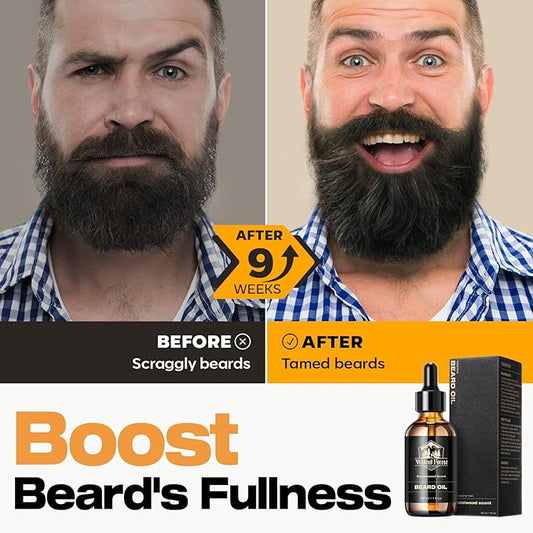 Waking Forest Sandalwood Beard Oil for Men - Biotin Mustache Oil with Vitamin E, Rosemary & Castor - Beard Care Softener, Strengthens, and Moisturizes - Beard Conditioner (1 oz)