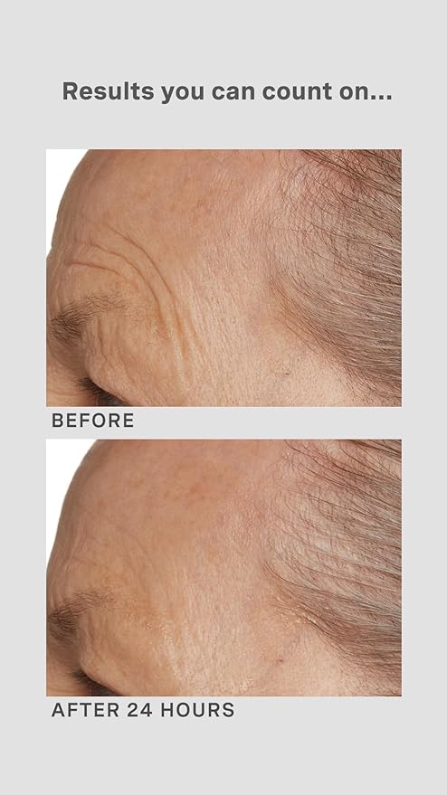 Lancer Gravity Defying Moisturizer With Firming Technology, Face Moisturizer for Women, Great at Boosting Collagen, Hydration, Anti-Aging and Firmness