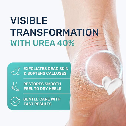Urea Cream 40% & Salicylic Acid – Intensive Callus Remover for Feet – Maximum Strength Exfoliating Lotion with Ceramides, Peptides & Tea Tree – Repair Dry Cracked Heels & Corns – 4.3 oz