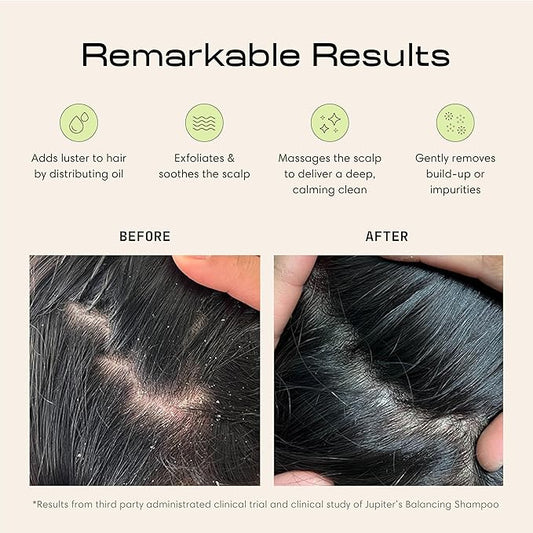 Jupiter Scalp Exfoliator - Scalp Massager Tool for Wet & Dry Hair - Ergonomic Detangler Brush - Dandruff Comb & Scrub to Remove Dandruff & Buildup and Support Circulation - White