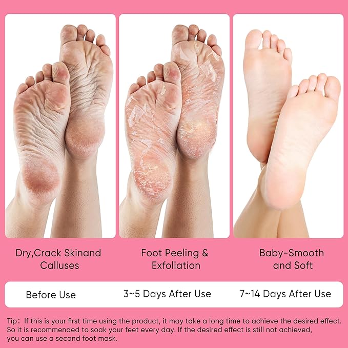Peach Foot Peeling Mask, 3 Pairs of Skin Exfoliating Foot Masks for Dry feet, Cracked heels, Callus, Dead Skin Remover, Smooth Touch Feet, Spa Experience at Home or Travel