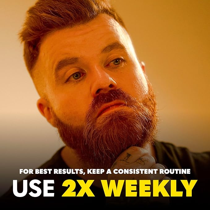 The Beard Club Derma Roller for Face, Body and Scalp - Microneedling for Men and Women with 540 Titanium Microneedles - Beard Roller & Micro Needling Scalp Hair - Black