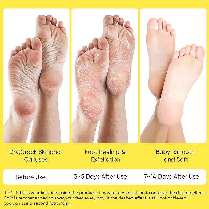 Foot Peeling Mask for Dry Cracked Feet(3 Pairs) - Exfoliating Feet Mask Peel with Natural Shea Butter Extract for Dry Cracked Extreme and Removing Dead Skin