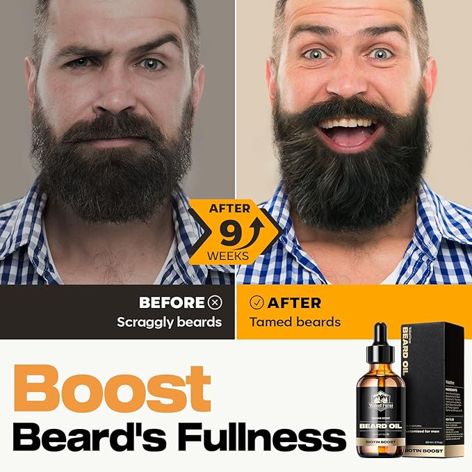 Waking Forest Cedar Beard Oil for Men - Biotin Mustache Oil with Vitamin E, Rosemary & Castor - Beard Care Softener, Strengthens, and Moisturizes - Beard Conditioner (2 oz)