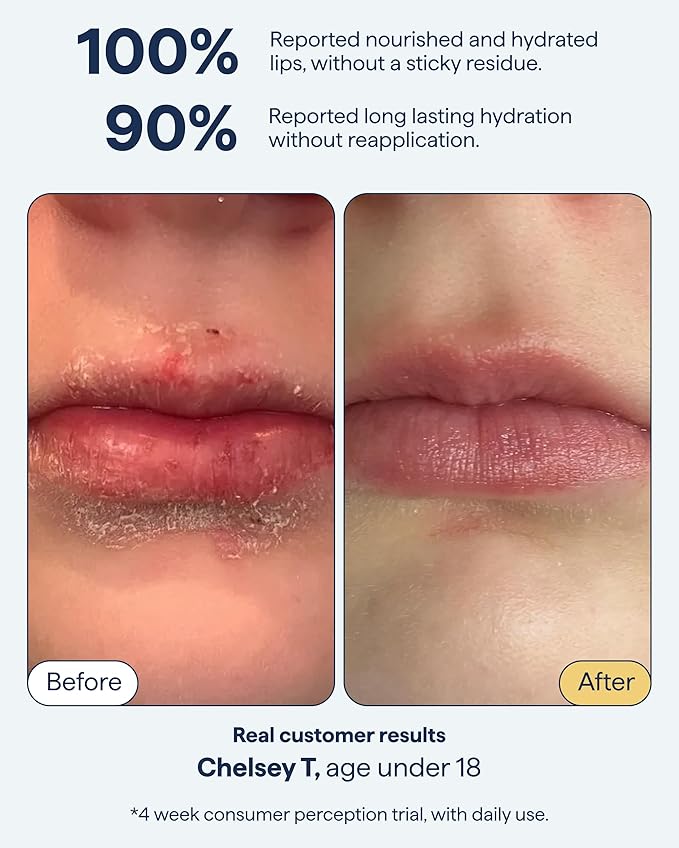 Remedy for Dry Lips - Hydrating and Healing Lip Balm Ointment with Ceramides, Peptides, and Dimethicone - Repairs Dry, Cracked Lips - By Dermatologist Dr. Shah