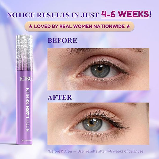 Lash Serum for Eyelash Growth, Premium Lash Enhancing Serum for Women & Men with Advanced Formula Volumizing Longer Fuller and Thicker Looking Lashes, Vegan & Cruelty-Free