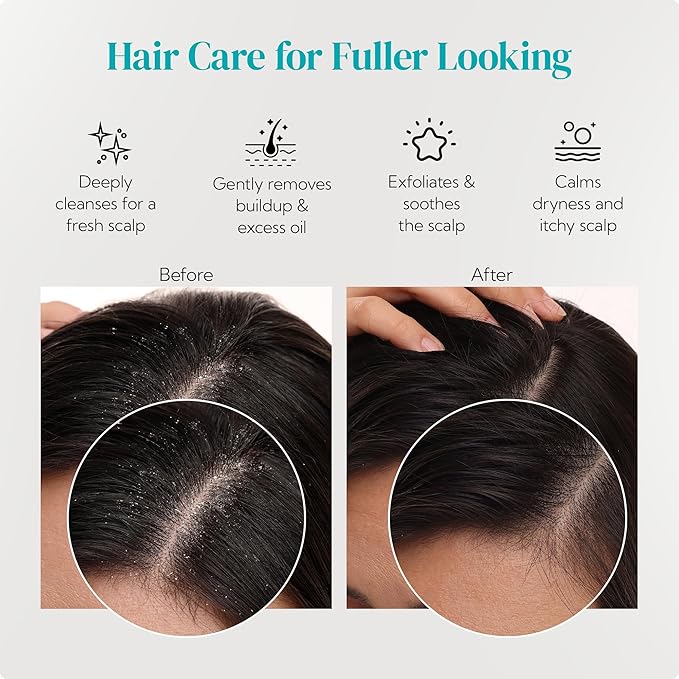 HEETA Scalp Massager 2 Pack for Hair Growth, Soft Silicone Bristles to Remove Dandruff and Relieve Itching, Scalp Scrubber for Hair Care Relax, Shampoo Brush for Wet Dry Use - New Pink & Blue