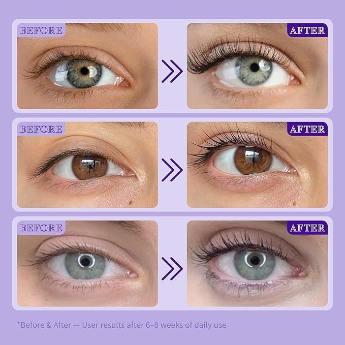 Lash Serum for Eyelash Growth, Advanced Peptide & Biotin Formula for Thicker, Fuller, Longer Lashes in 4-6 Weeks, Prostaglandin-Free Lash Enhancer for Women 35+ (Eyelash Serum - 16mL)