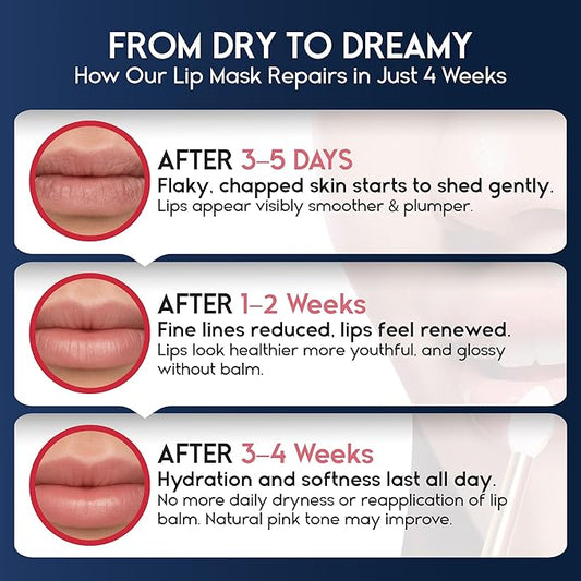 Lip Mask Overnight with Hyaluronic Acid & Collagen, Lip Sleeping Mask for Dry Cracked Lips, Moisturizing, Hydrating, Exfoliating Night Treatment for Lip Care (Peach) (0.7, Strawberry)